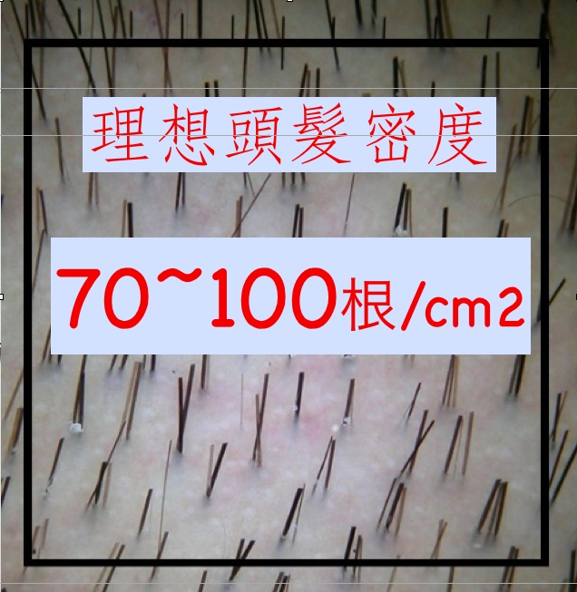 理想頭髮密度 2013-06-09 上午10.07.50