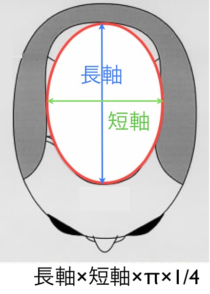禿頭面積計算 part II 橢圓形  2013-07-02 下午5.22.31