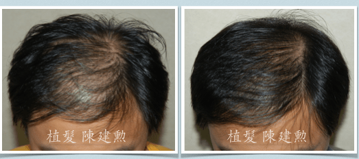 スクリーンショット 2015-10-15 午後8.44.11