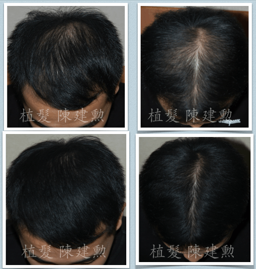 スクリーンショット 2015-10-30 午前11.09.42