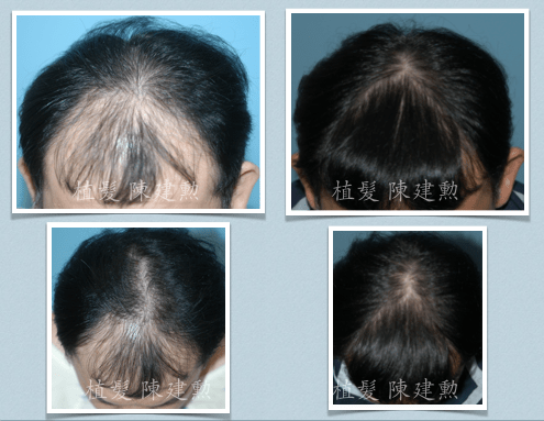 スクリーンショット 2016-01-03 午後4.00.24