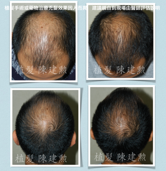 e382b9e382afe383aae383bce383b3e382b7e383a7e38383e38388-2015-06-09-e58d88e5be8c4-50-40