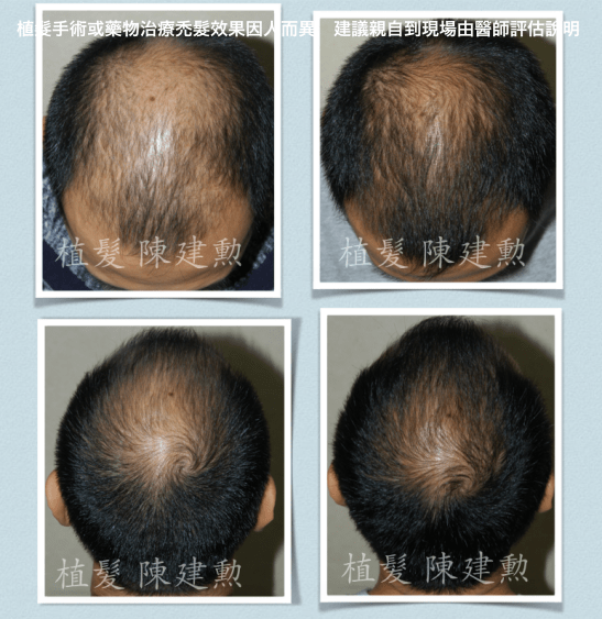 e382b9e382afe383aae383bce383b3e382b7e383a7e38383e38388-2015-06-09-e58d88e5be8c4-50-40