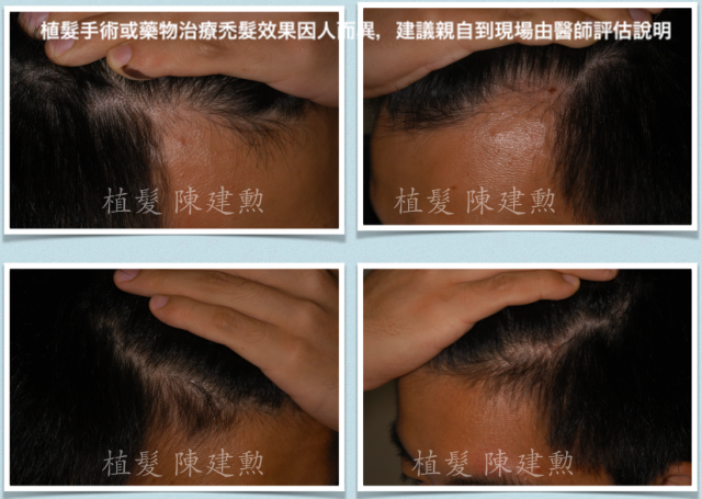 e382b9e382afe383aae383bce383b3e382b7e383a7e38383e38388-2015-06-14-e58d88e5be8c2-12-05