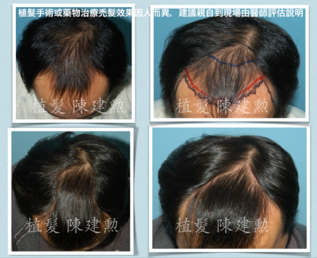 e382b9e382afe383aae383bce383b3e382b7e383a7e38383e38388-2015-06-18-e58d88e5be8c9-09-29