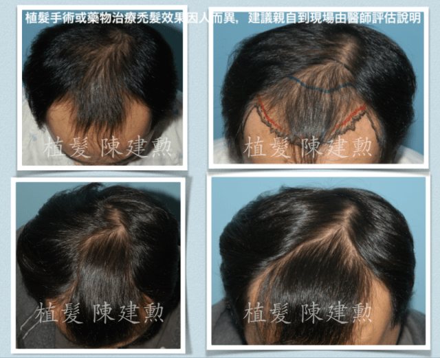 e382b9e382afe383aae383bce383b3e382b7e383a7e38383e38388-2015-06-18-e58d88e5be8c9-09-29