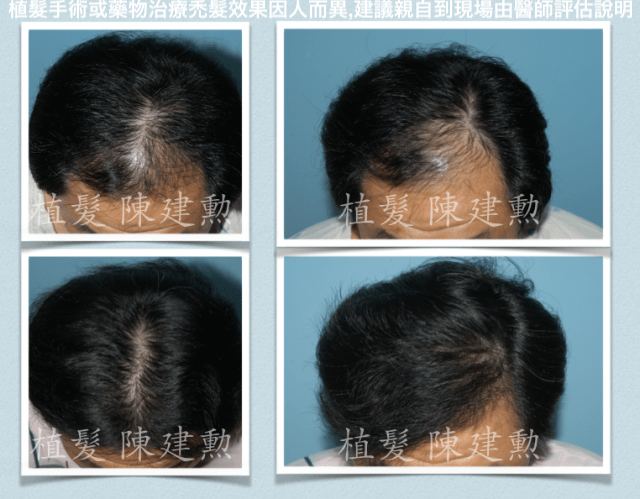 e382b9e382afe383aae383bce383b3e382b7e383a7e38383e38388-2015-07-12-e58d88e5898d11-06-48